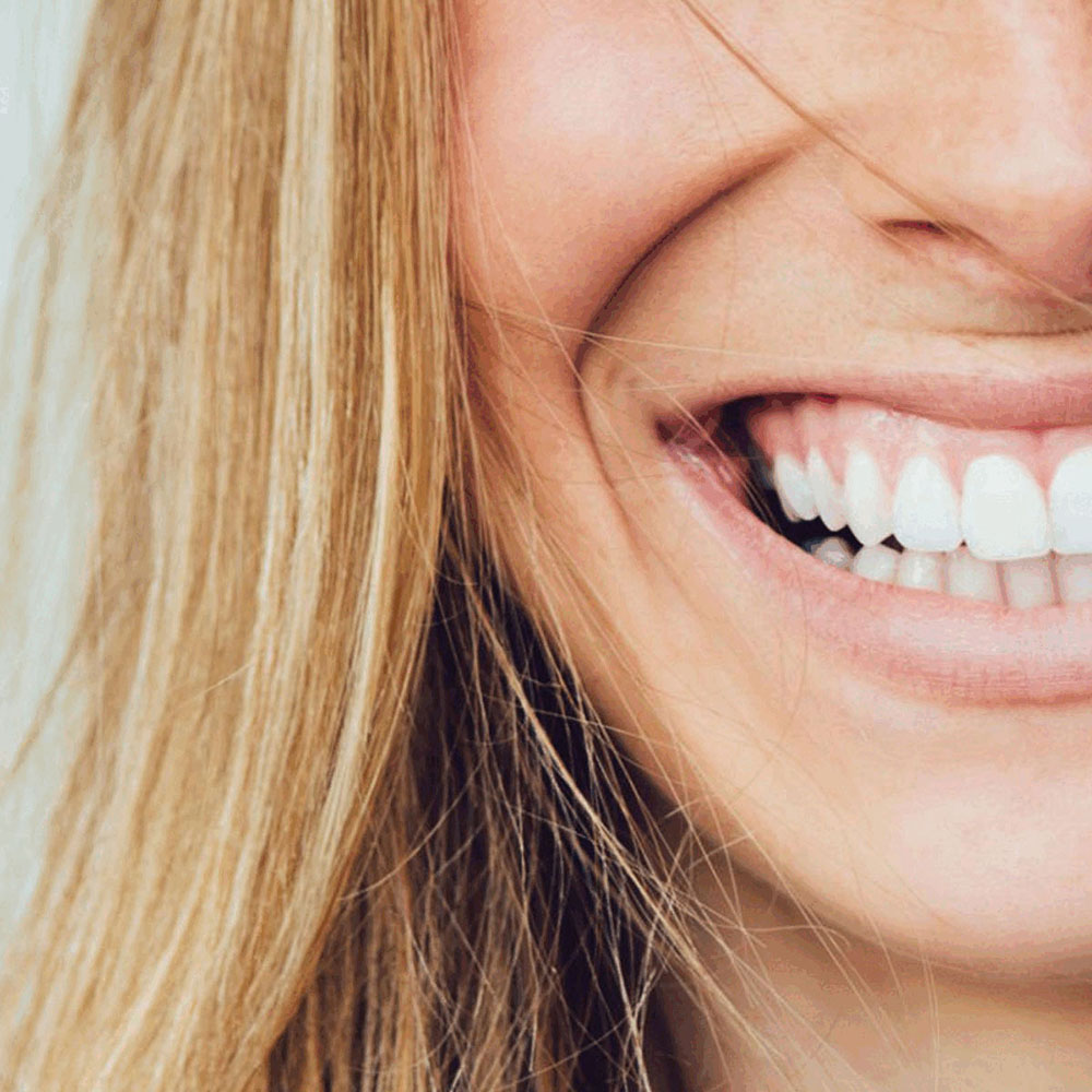 SMILE2